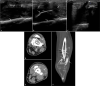 Fig. 12.