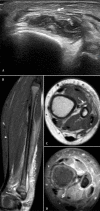 Fig. 10.