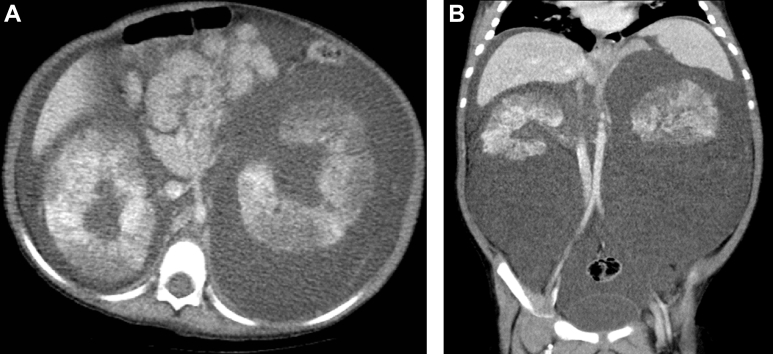 Fig. 2