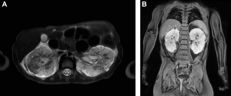 Fig. 3