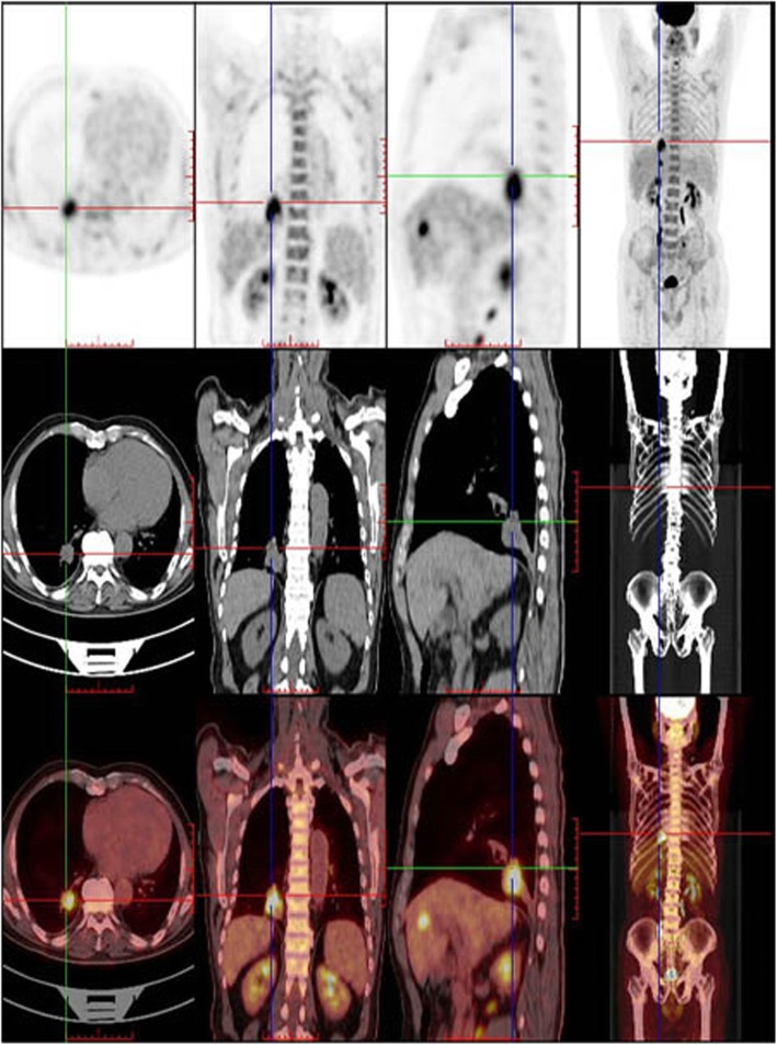 Fig. 1