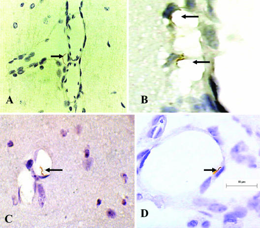 FIG.2.