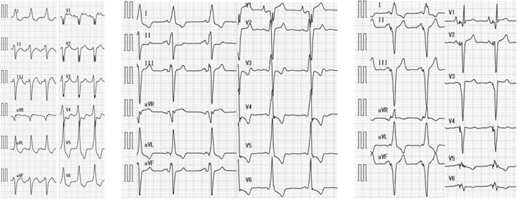 Figure 2