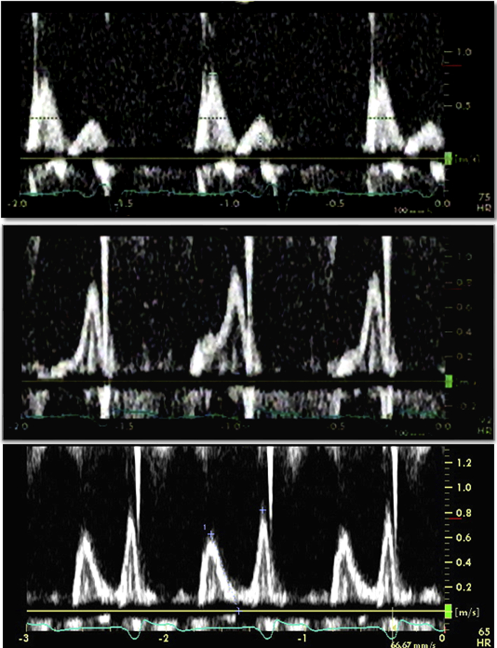 Figure 5