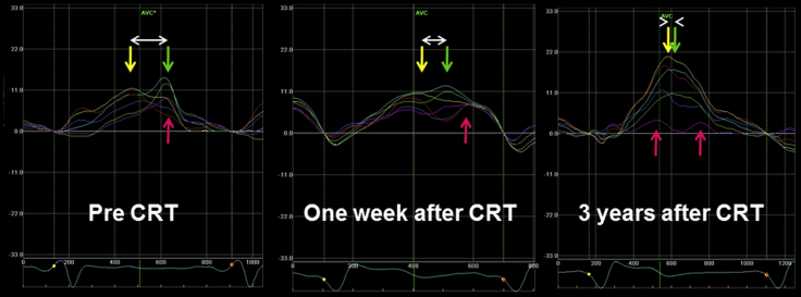 Figure 3