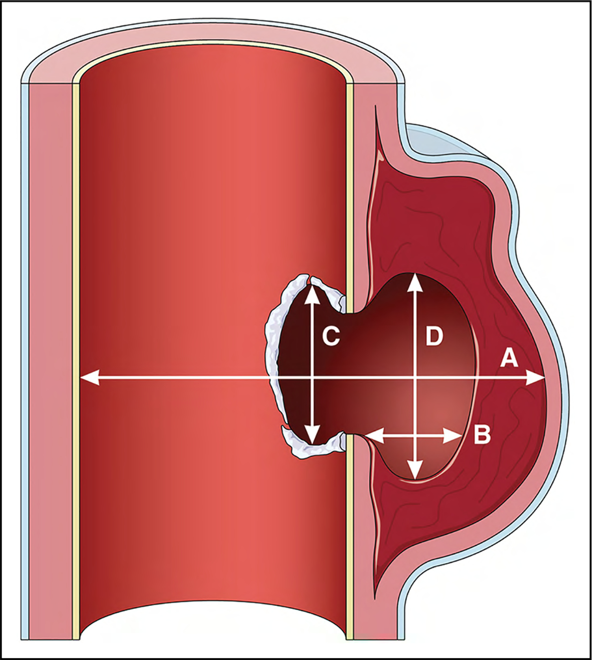 Figure 22.