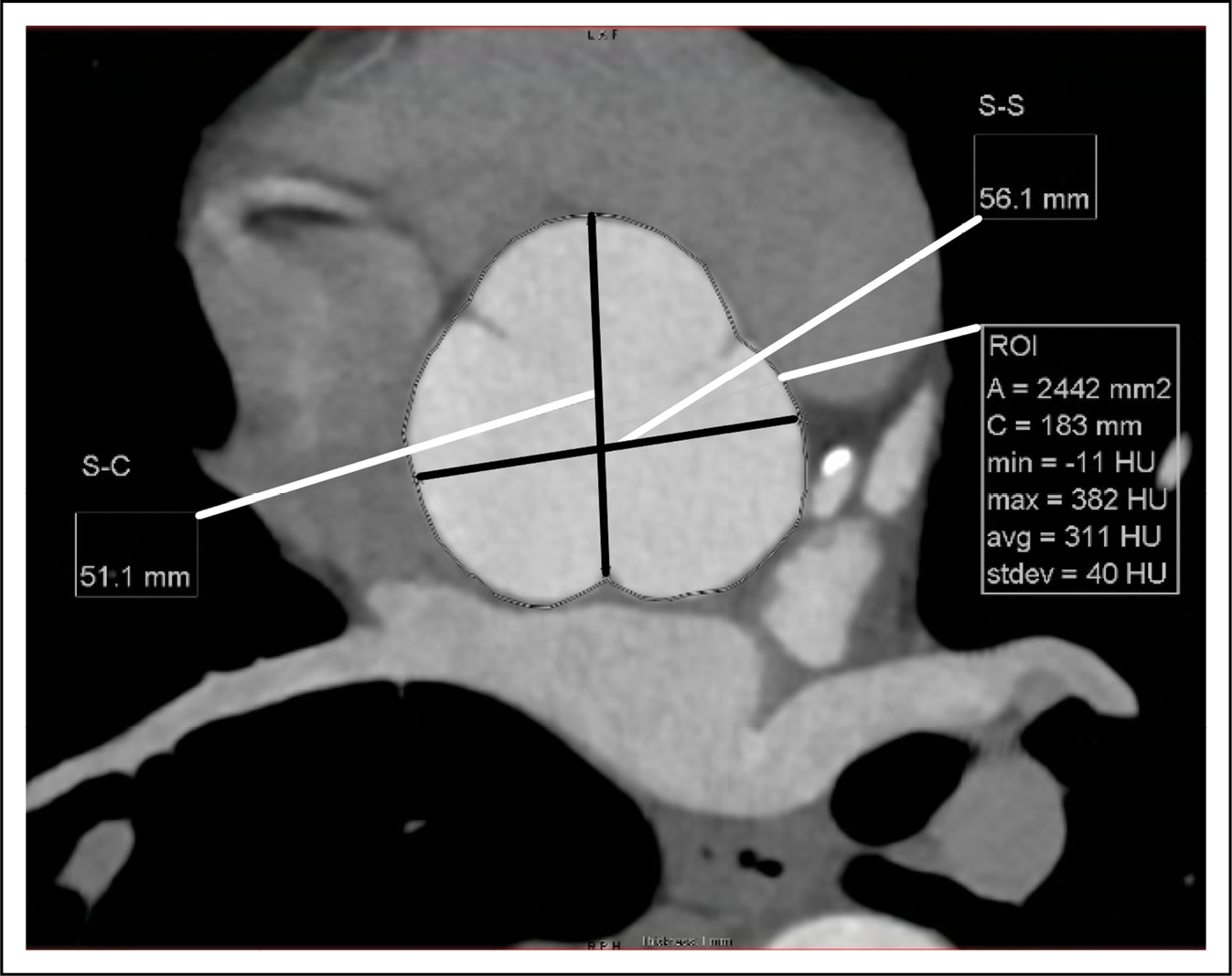 Figure 13.