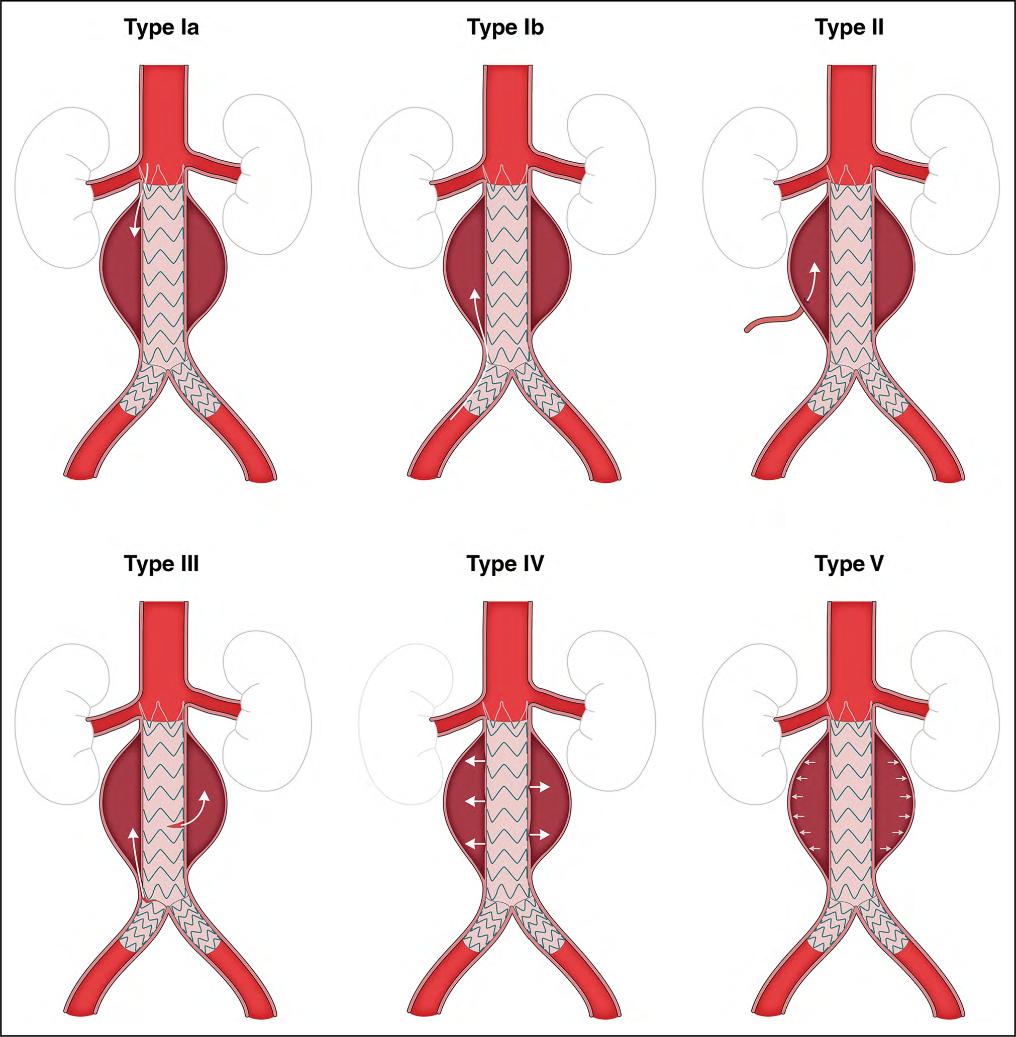 Figure 11.