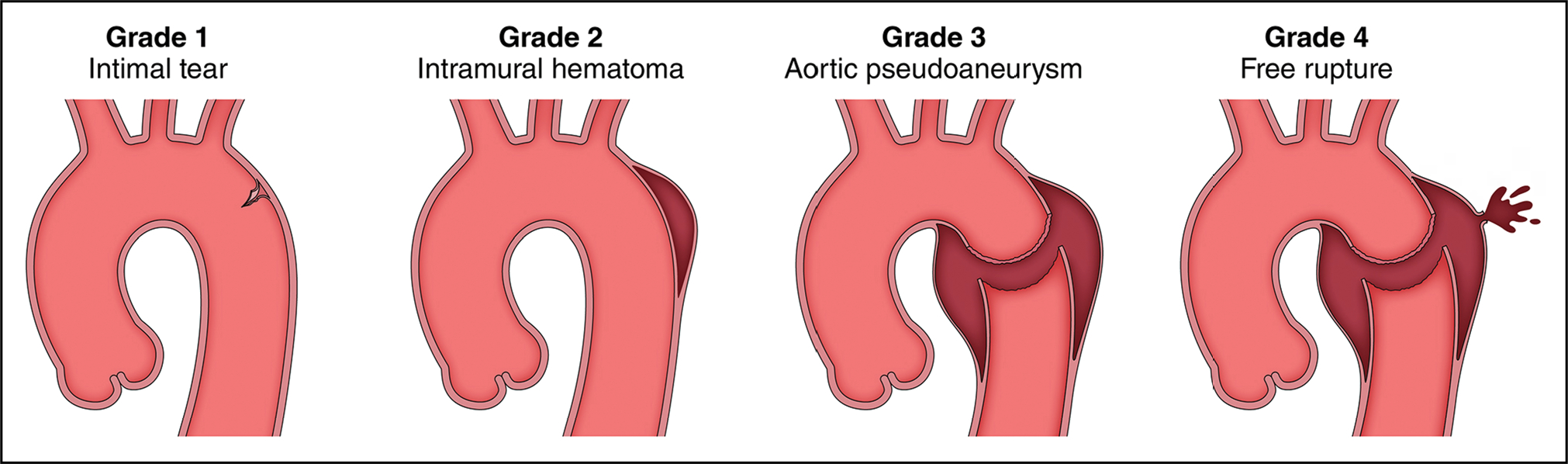 Figure 23.