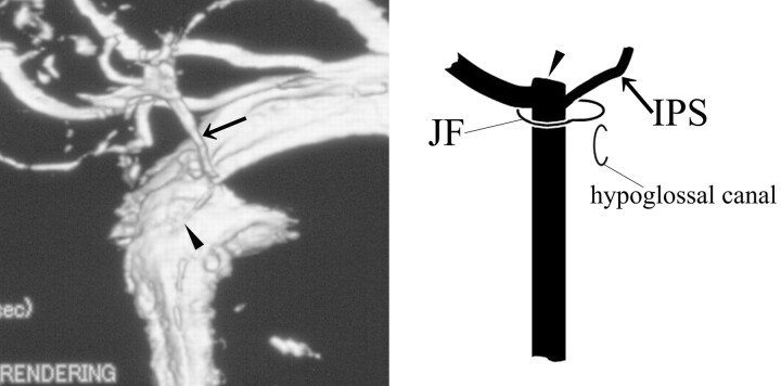 Fig 2.