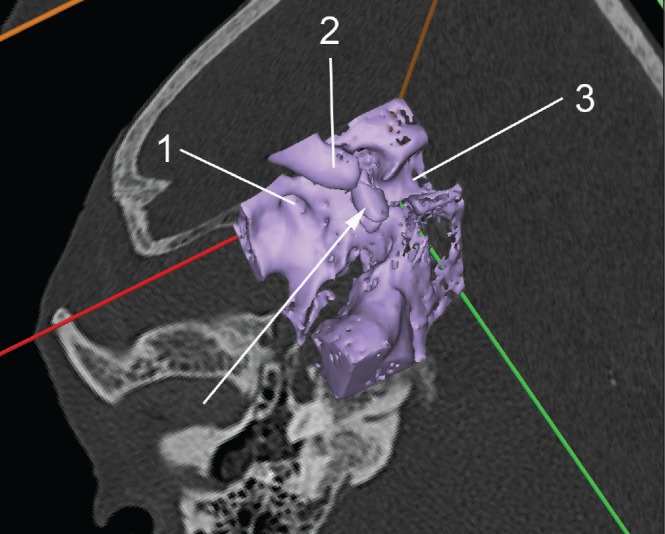 Figure 3