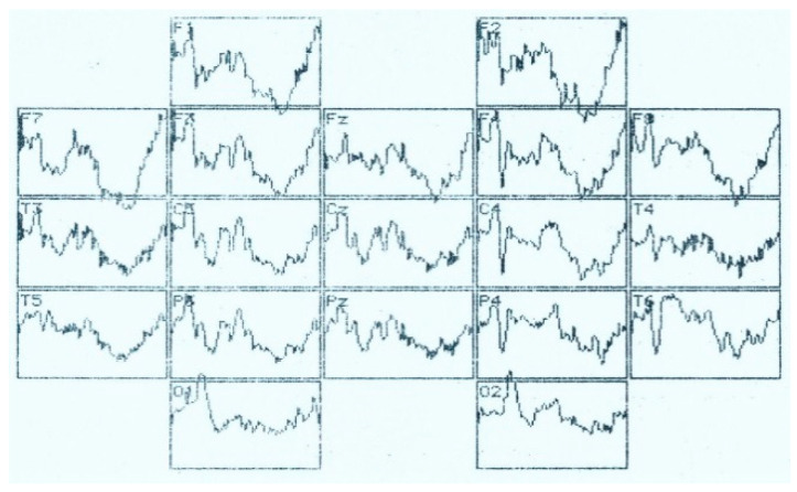 Figure 12