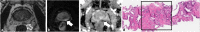 Fig. 14
