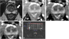 Fig. 13