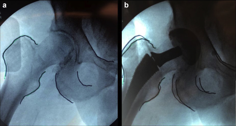 Figure 2