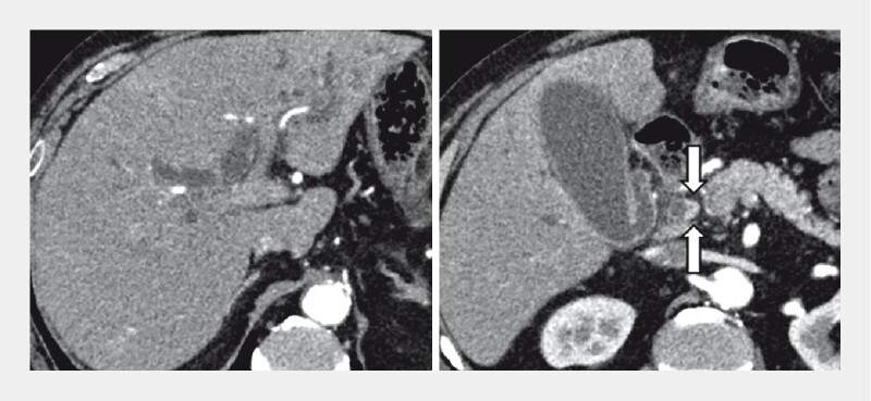 Fig. 1