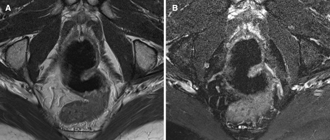 Fig. 6