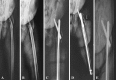 Fig. 1A–E