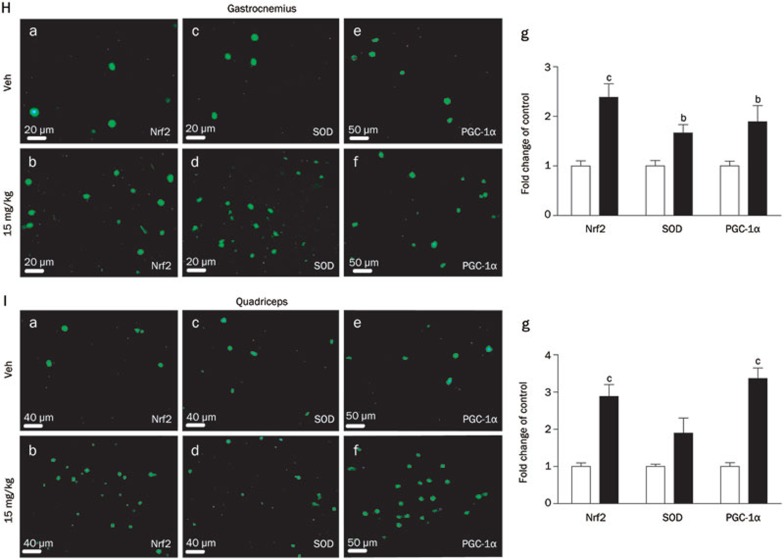 Figure 4H–4I