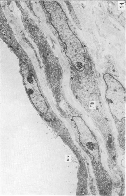 Fig. 14