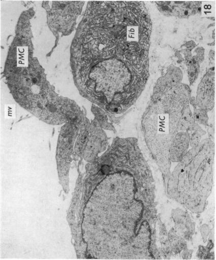 Fig. 18