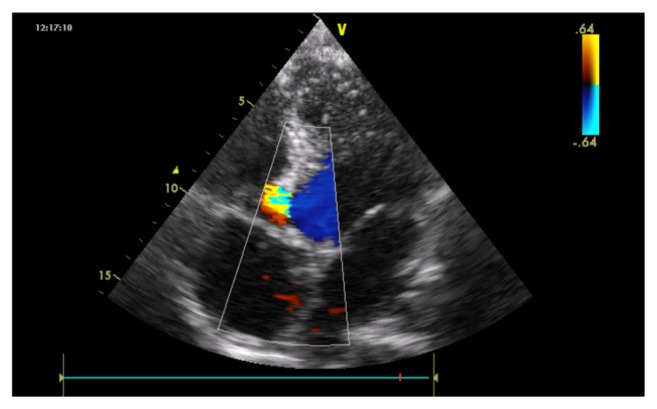 Figure 4