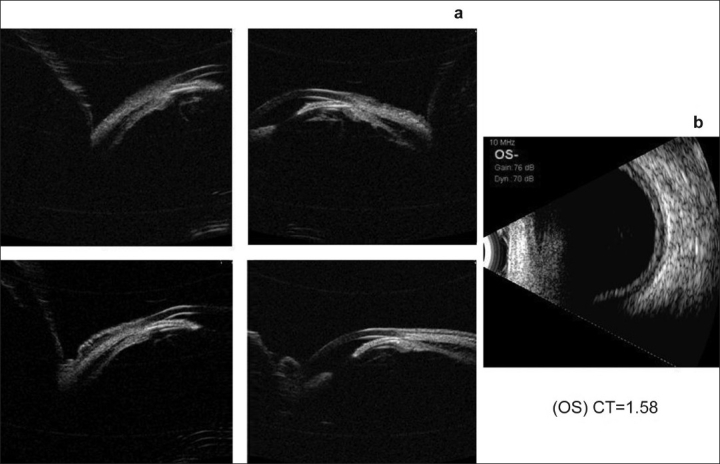 Figure 5