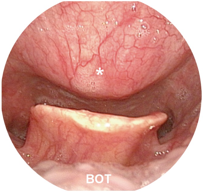 Fig. 1