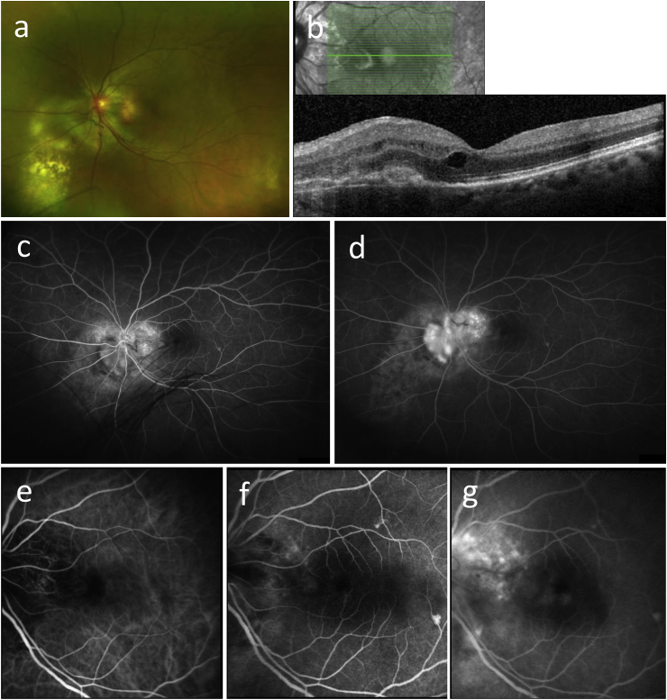 Fig. 1