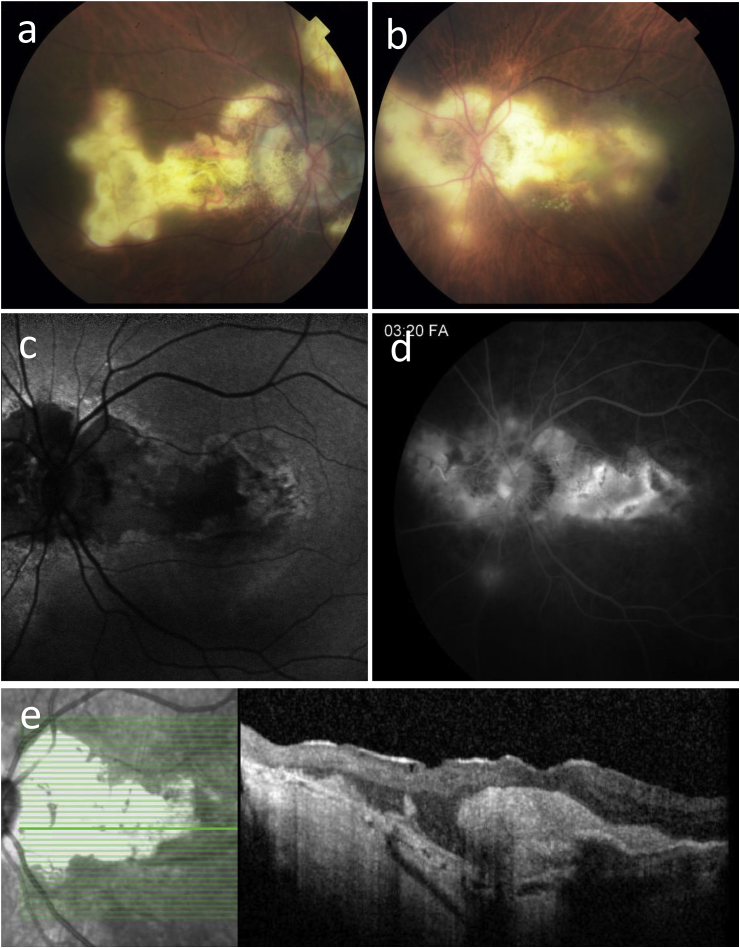 Fig. 2