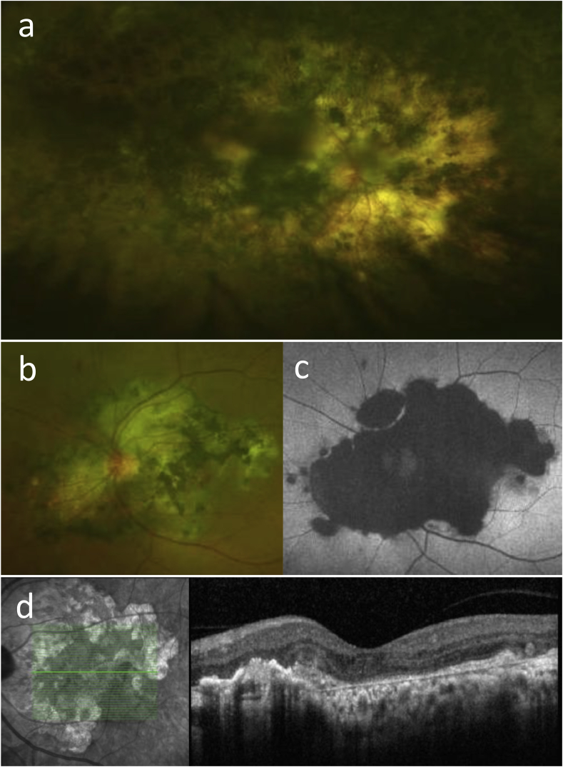 Fig. 4