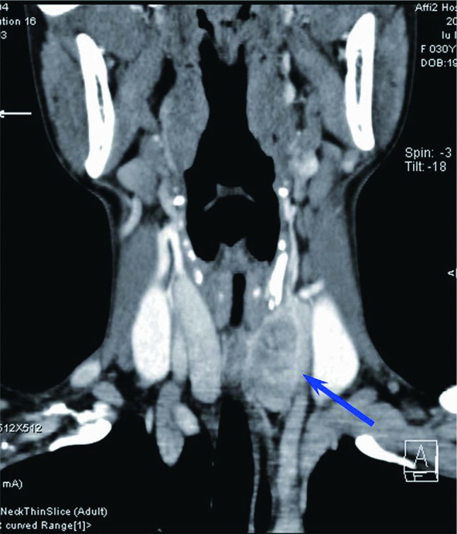 Fig. 2