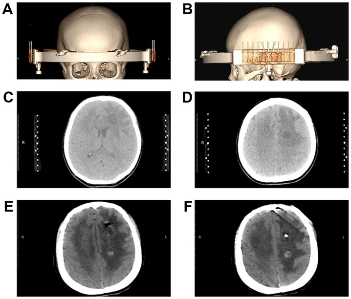 Figure 3.