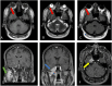 Fig 2: