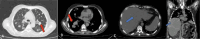 Fig 4: