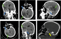 Fig 3: