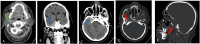 Fig 1: