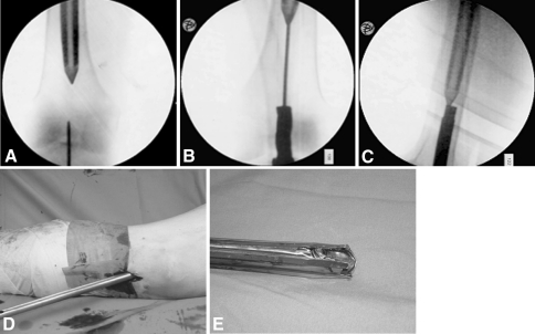 Fig. 4A–E