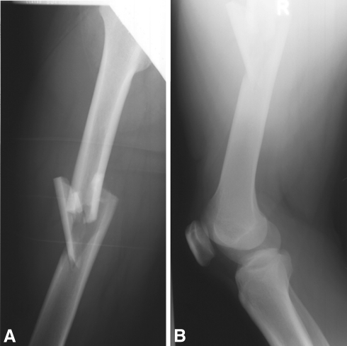 Fig. 1A–B