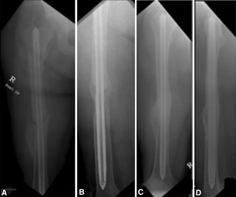 Fig. 3A–D