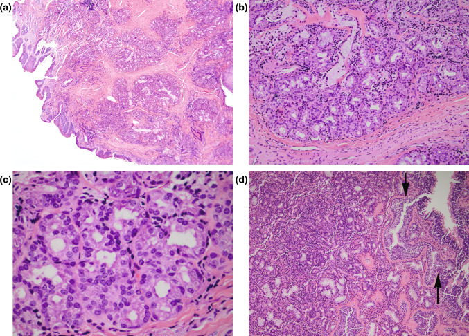 Fig. 1