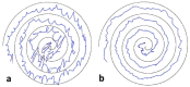 Visualization of the patient’s tremor during Archimedian spiral drawing