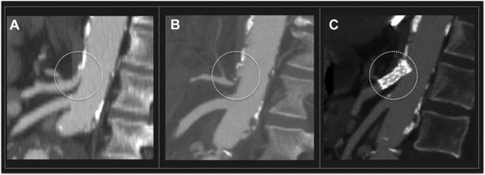 Fig. 1