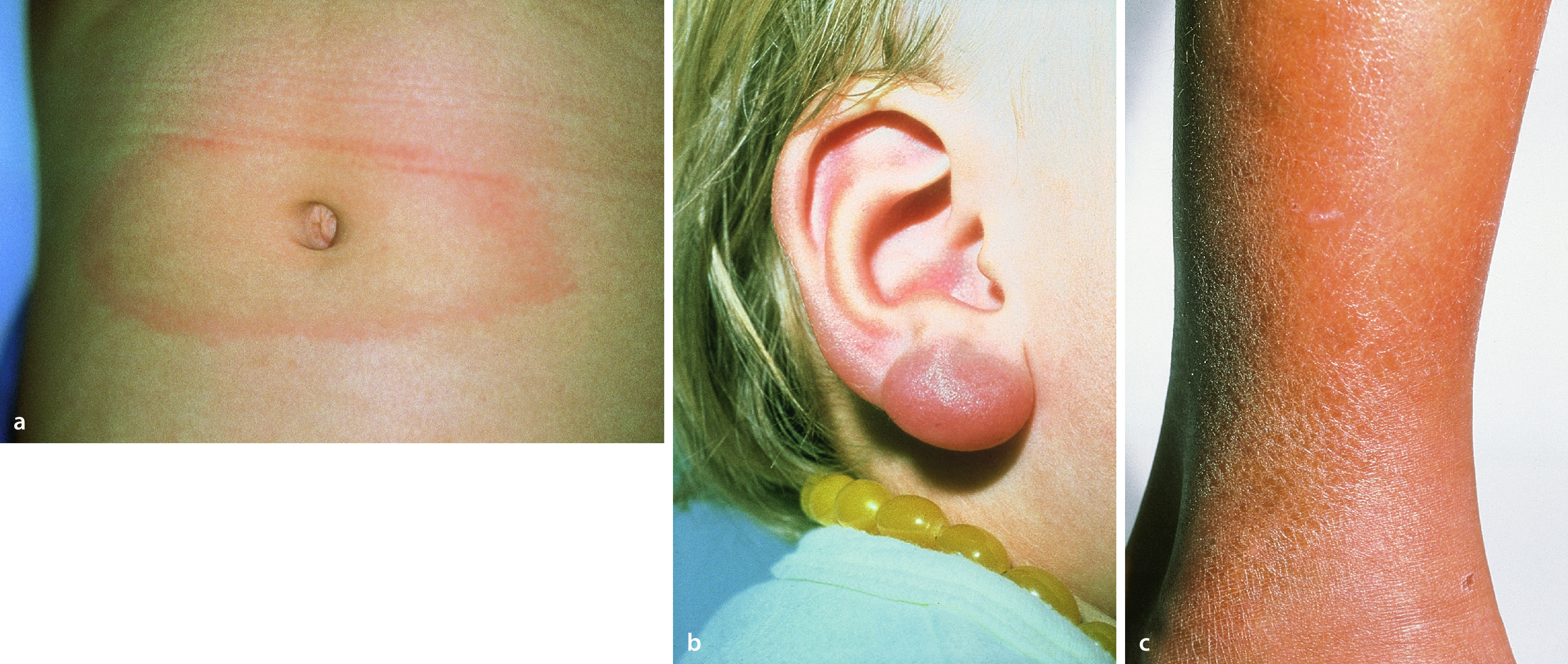graphic file with name 978-3-662-57295-5_15_Fig4_Print.jpg