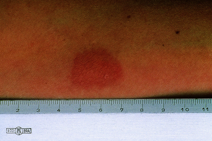 graphic file with name 978-3-662-57295-5_15_Fig15_Print.jpg