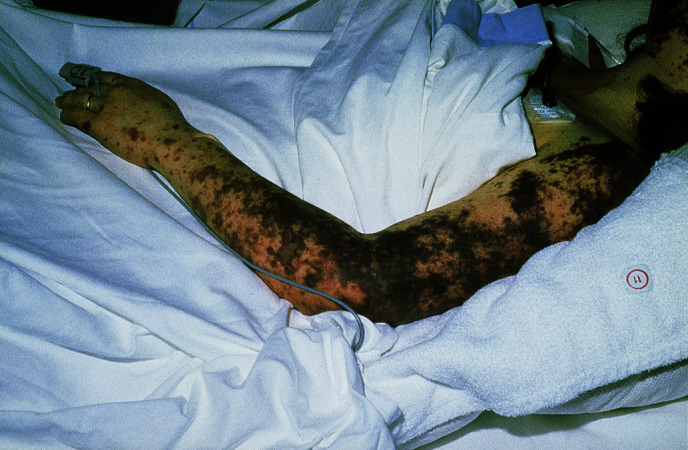 graphic file with name 978-3-662-57295-5_15_Fig2_Print.jpg