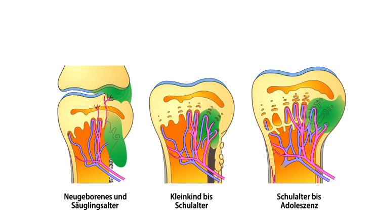 graphic file with name 978-3-662-57295-5_15_Fig21_Print.jpg