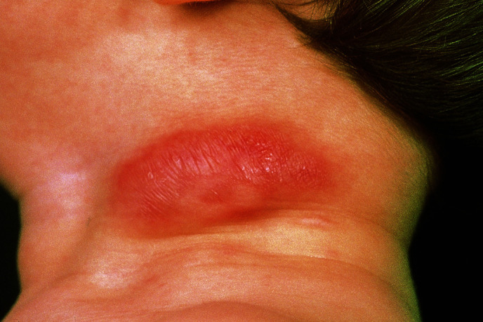 graphic file with name 978-3-662-57295-5_15_Fig10_Print.jpg