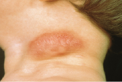 graphic file with name 978-3-662-57295-5_15_Fig10_HTML.jpg