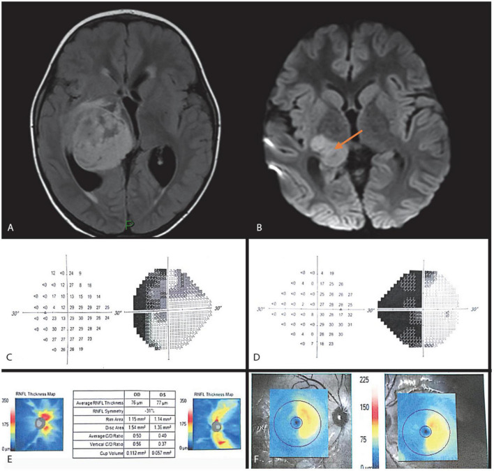 FIGURE 3